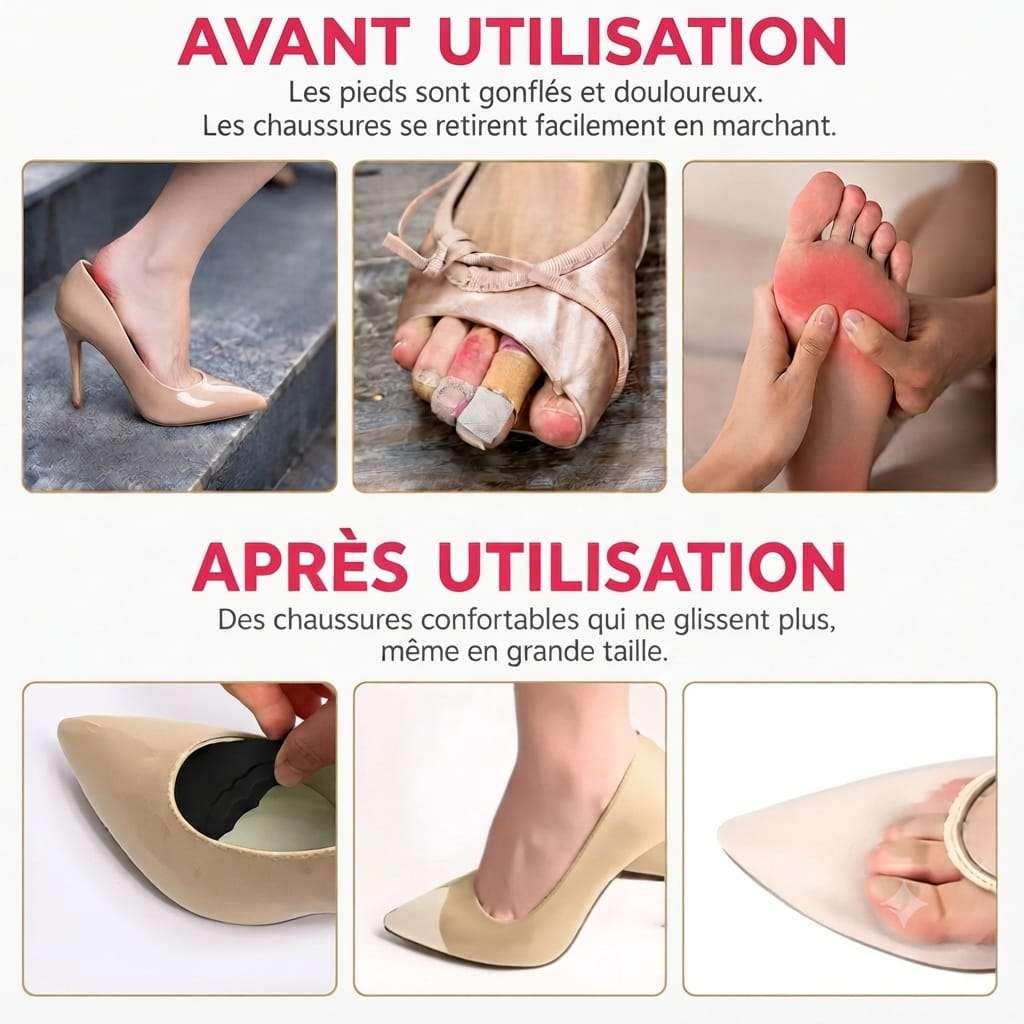 Coussinets Confort pour Chaussures